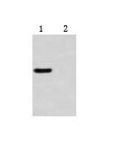 Boster Bio Mitochondria Isolation Kit SKU: AR0156 package