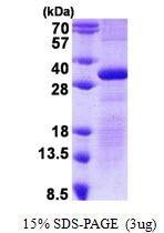 US Biological SGCD, Recombinant, Human, aa57-289, His-Tag (Delta-sarcoglycan, 35DAG, CMD1L, DAGD, SG-delta, SGCDP, SGD) SKU: 137207 package