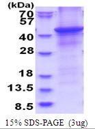 US Biological HAPLN1, Recombinant, Human, aa16-354, His-Tag (Hyaluronan And Proteoglycan Link Protein 1 Precursor) SKU: 218211 package