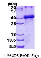US Biological BGN, Recombinant, Human, aa38-368, His-Tag (Biglycan Preproprotein, DSPG1, PG-S1, PGI, SLRR1A) SKU: 137004 package