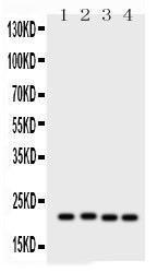 US Biological Rabbit Anti-human SOCS2 polyclonal antibody SKU:303625 package