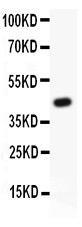 US Biological Rabbit Anti-human GLI1 polyclonal antibody SKU:303331 package