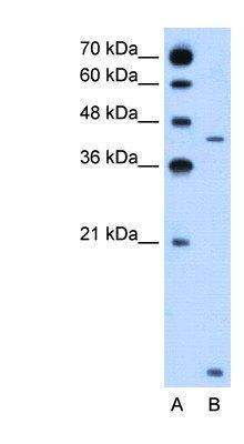 US Biological Rabbit Anti-human SLC46A3 polyclonal antibody SKU:138379 package