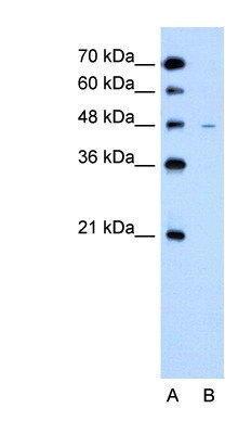 US Biological Rabbit Anti-human SLC43A3 polyclonal antibody SKU:138378 package