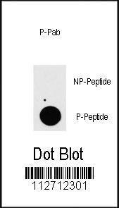 US Biological Rabbit Anti-human TAB1, phosphorylated polyclonal antibody SKU:T0291-85H-PE package