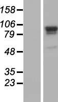 OriGene Human ORF Clone minichromosome maintenance complex component 4 (MCM4), transcript variant 2 package